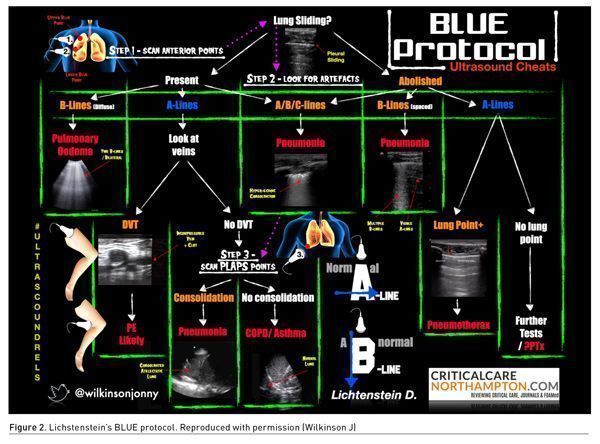 [ICU Management & Practice]: 床旁超声：危重病患者的关键影像学检查关键工具 | 中国病理生理学会危重病医学专业委员会