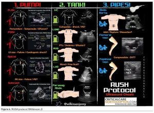 [ICU Management & Practice]: 床旁超声：危重病患者的关键影像学检查关键工具 | 中国病理生理学会危重病医学专业委员会