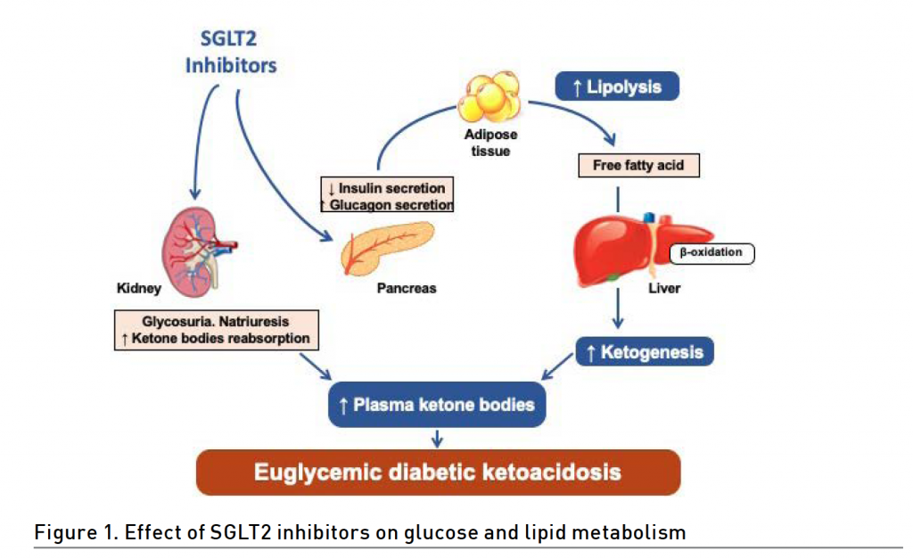 [ICU Management & Practice]: 发现SGLT2抑制剂相关的正常血糖性糖尿病酮症酸中毒