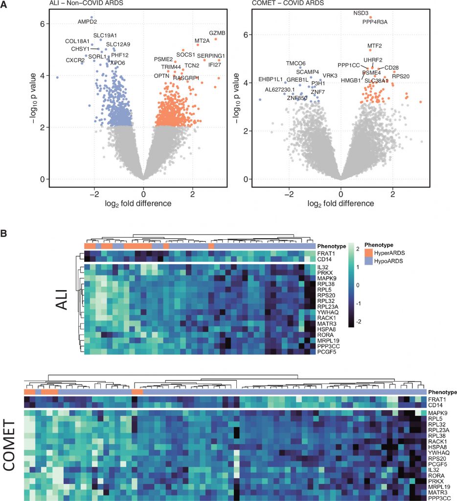 [Blue发表论文]：ARDS分子表型具有不同的下呼吸道转录组